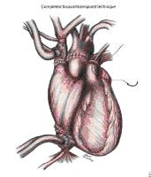 Бикавальная методика